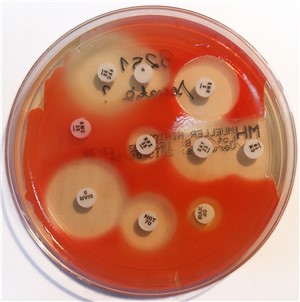 Prodigiosin pigment produced by bacteria