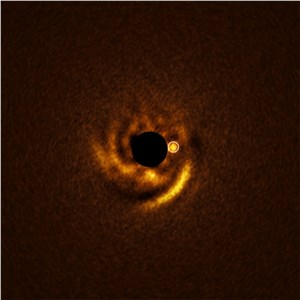 Disc and a candidate planet around the star (ERIS) European Southern Observatory (ESO) &copy;